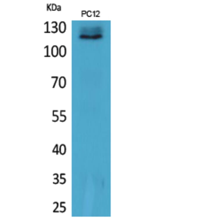 Western Blot - Anti-UBA1 Antibody (C30999) - Antibodies.com