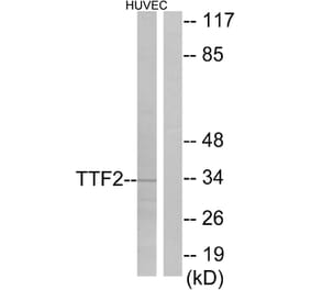Western Blot - Anti-TTF2 Antibody (C10022) - Antibodies.com