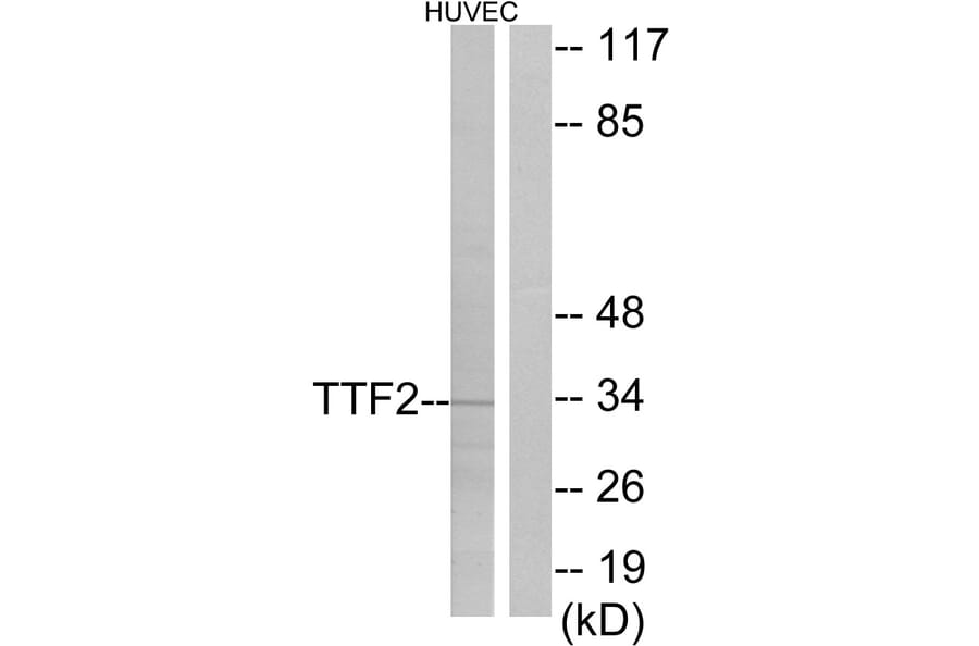 Western Blot - Anti-TTF2 Antibody (C10022) - Antibodies.com