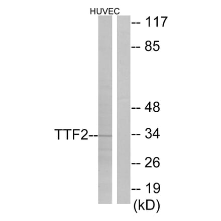 Western Blot - Anti-TTF2 Antibody (C10022) - Antibodies.com