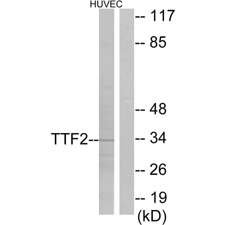Western Blot - Anti-TTF2 Antibody (C10022) - Antibodies.com