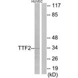 Western Blot - Anti-TTF2 Antibody (C10022) - Antibodies.com