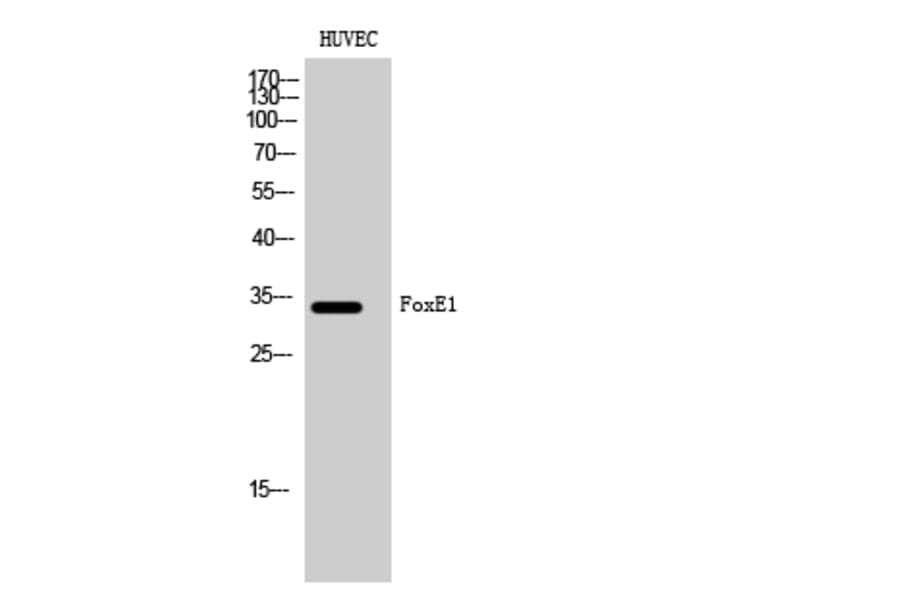 Western Blot - Anti-TTF2 Antibody (C10022) - Antibodies.com