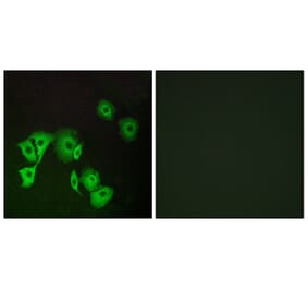 Immunofluorescence - Anti-TTF2 Antibody (C19640) - Antibodies.com