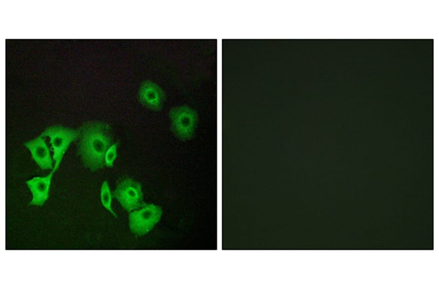 Immunofluorescence - Anti-TTF2 Antibody (C19640) - Antibodies.com
