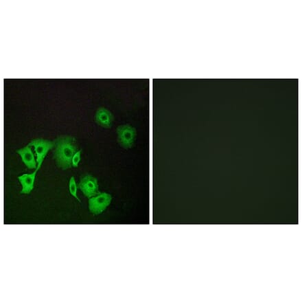 Immunofluorescence - Anti-TTF2 Antibody (C19640) - Antibodies.com