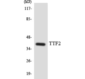 Western Blot - Anti-TTF2 Antibody (R12-3657) - Antibodies.com