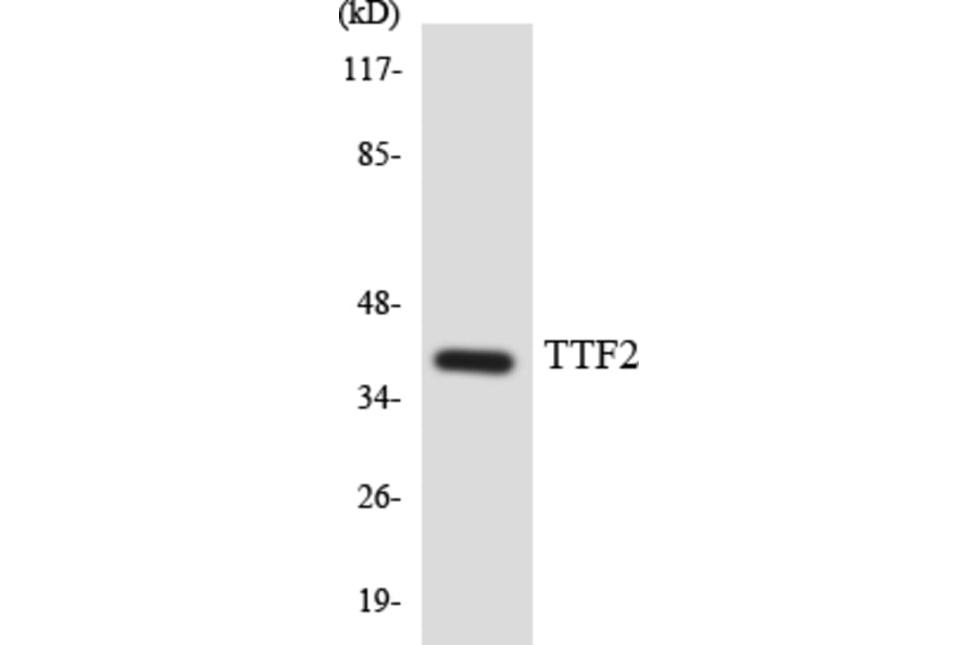 Western Blot - Anti-TTF2 Antibody (R12-3657) - Antibodies.com