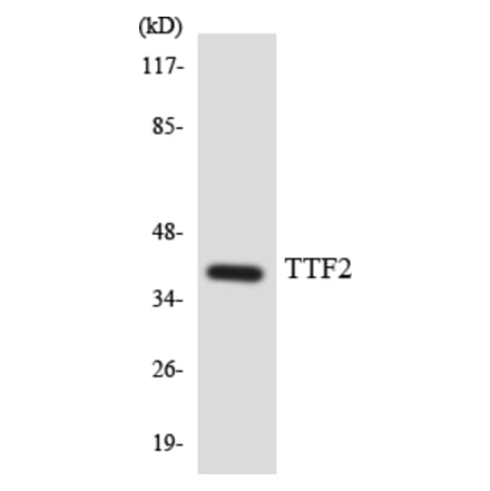 Western Blot - Anti-TTF2 Antibody (R12-3657) - Antibodies.com