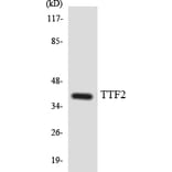 Western Blot - Anti-TTF2 Antibody (R12-3657) - Antibodies.com