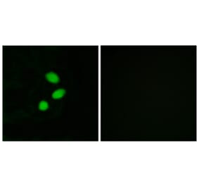 Immunofluorescence - Anti-TSH2 Antibody (C11748) - Antibodies.com