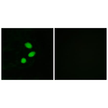 Immunofluorescence - Anti-TSH2 Antibody (C11748) - Antibodies.com