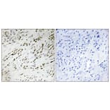 Immunohistochemistry - Anti-TSH2 Antibody (C11748) - Antibodies.com