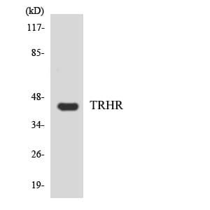 Western blot analysis of the lysates from HepG2 cells using Anti-TRHR Antibody.