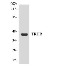 Western Blot - Anti-TRHR Antibody (R12-3649) - Antibodies.com
