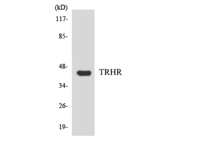 Western Blot - Anti-TRHR Antibody (R12-3649) - Antibodies.com
