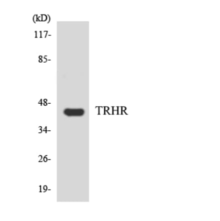 Western Blot - Anti-TRHR Antibody (R12-3649) - Antibodies.com