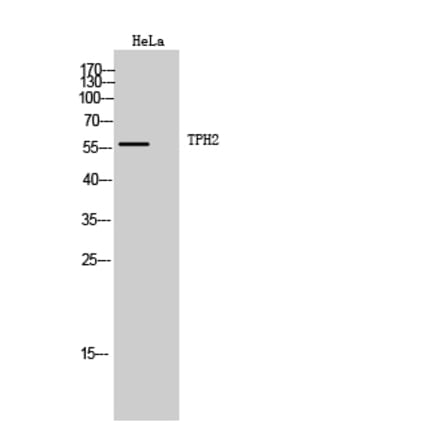 Western Blot - Anti-TPH2 Antibody (B8545) - Antibodies.com