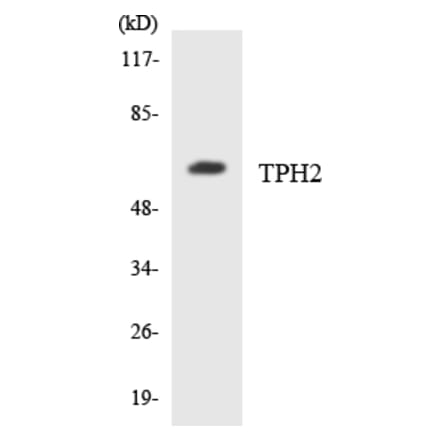 Western Blot - Anti-TPH2 Antibody (R12-3645) - Antibodies.com