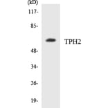 Western Blot - Anti-TPH2 Antibody (R12-3645) - Antibodies.com