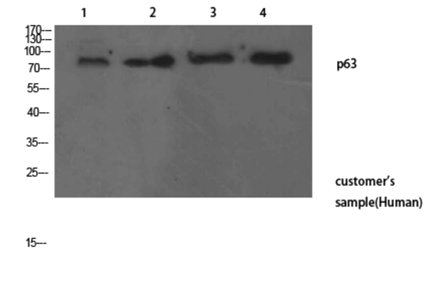 Western Blot - Anti-TP63 Antibody (C30107) - Antibodies.com