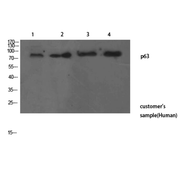 Western Blot - Anti-TP63 Antibody (C30107) - Antibodies.com