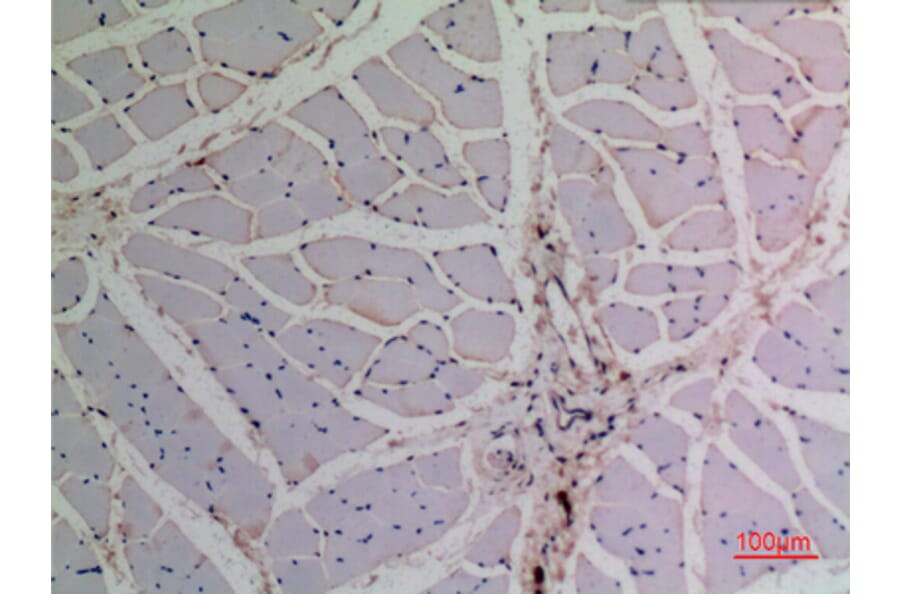 Immunohistochemistry - Anti-TP63 Antibody (C30107) - Antibodies.com