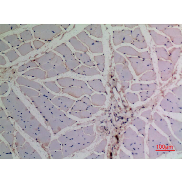 Immunohistochemistry - Anti-TP63 Antibody (C30107) - Antibodies.com