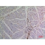 Immunohistochemistry - Anti-TP63 Antibody (C30107) - Antibodies.com