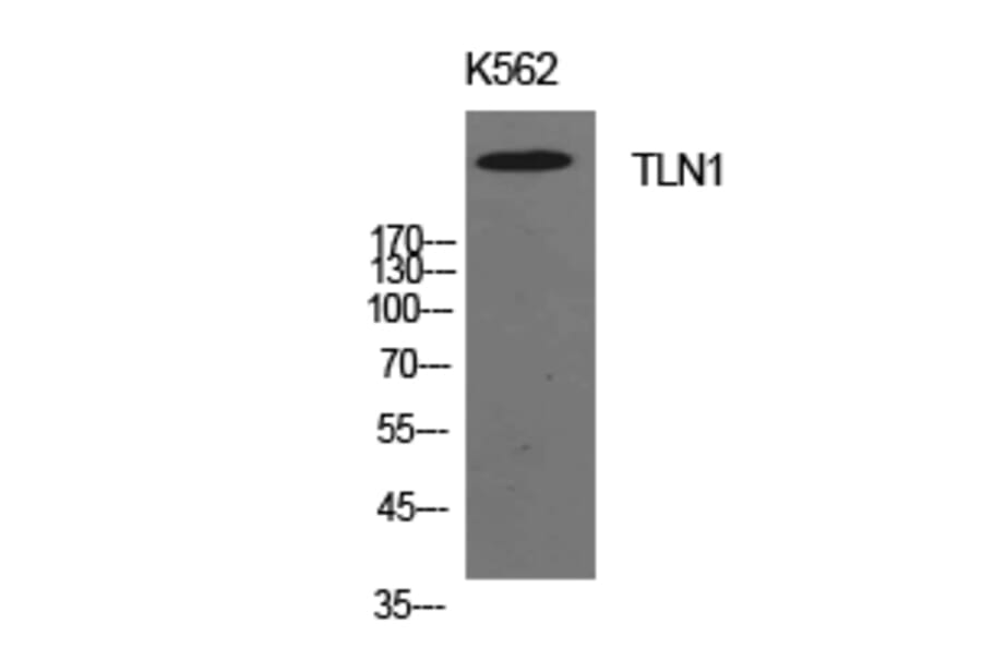 Western Blot - Anti-TLN1 Antibody (C30312) - Antibodies.com