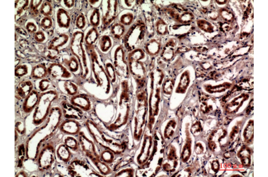 Immunohistochemistry - Anti-TLN1 Antibody (C30312) - Antibodies.com