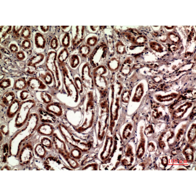 Immunohistochemistry - Anti-TLN1 Antibody (C30312) - Antibodies.com