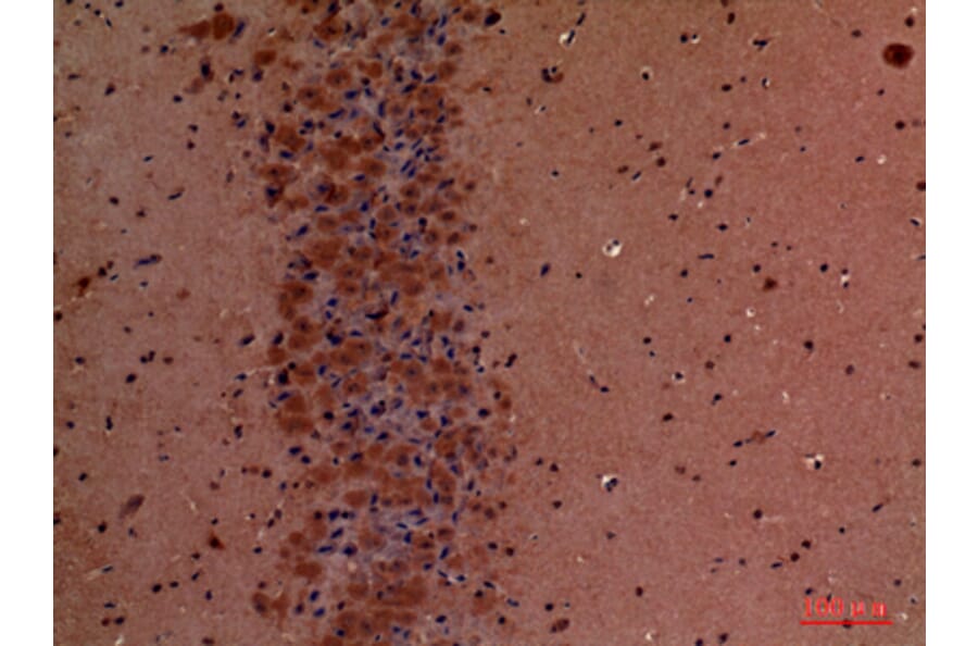 Immunohistochemistry - Anti-TLN1 Antibody (C30312) - Antibodies.com