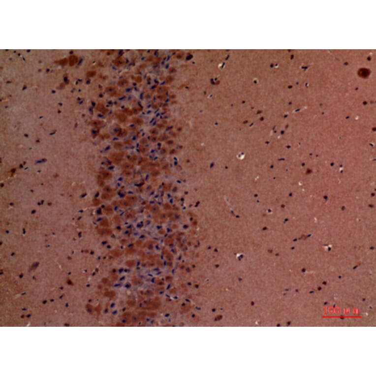 Immunohistochemistry - Anti-TLN1 Antibody (C30312) - Antibodies.com