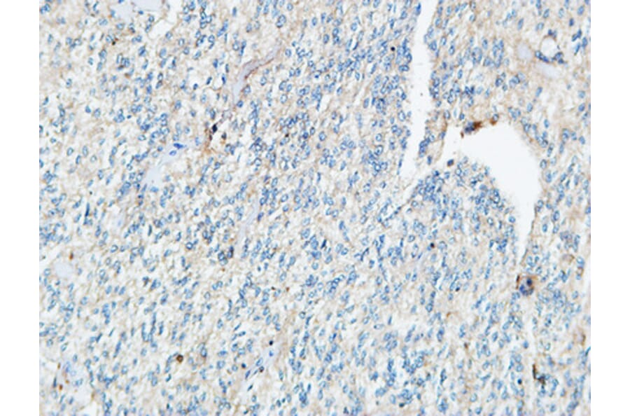 Immunohistochemistry - Anti-TIE1 Antibody (C19314) - Antibodies.com
