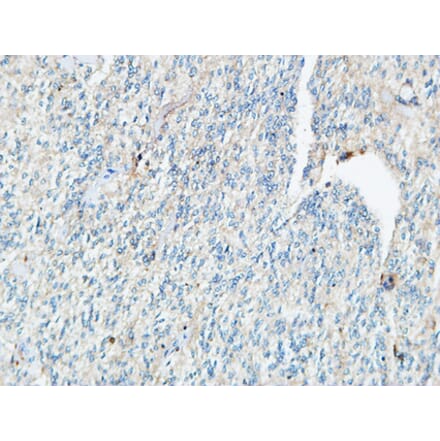 Immunohistochemistry - Anti-TIE1 Antibody (C19314) - Antibodies.com