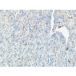 Immunohistochemistry - Anti-TIE1 Antibody (C19314) - Antibodies.com