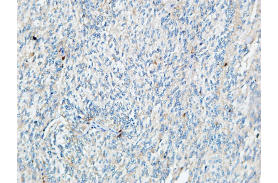 Immunohistochemistry - Anti-TIE1 Antibody (C19314) - Antibodies.com