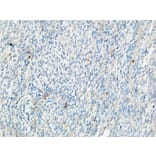 Immunohistochemistry - Anti-TIE1 Antibody (C19314) - Antibodies.com