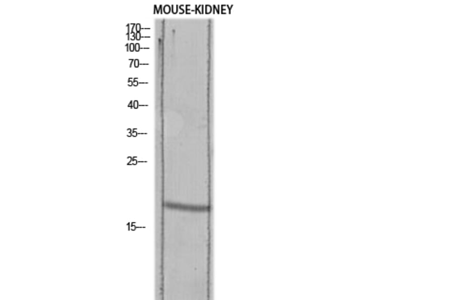 Western Blot - Anti-TGFA Antibody (C30170) - Antibodies.com