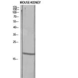 Western Blot - Anti-TGFA Antibody (C30170) - Antibodies.com