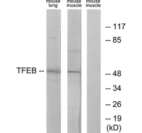 Western Blot - Anti-TFEB Antibody (C10428) - Antibodies.com