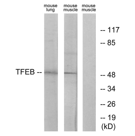 Western Blot - Anti-TFEB Antibody (C10428) - Antibodies.com
