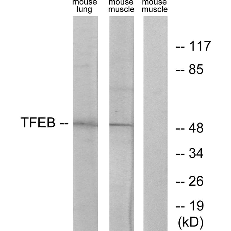 Western Blot - Anti-TFEB Antibody (C10428) - Antibodies.com