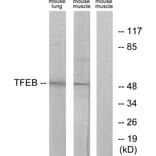 Western Blot - Anti-TFEB Antibody (C10428) - Antibodies.com