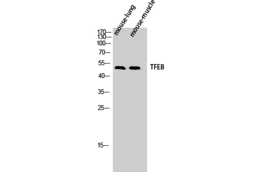 Western Blot - Anti-TFEB Antibody (C10428) - Antibodies.com