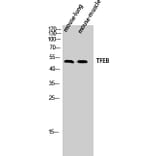 Western Blot - Anti-TFEB Antibody (C10428) - Antibodies.com