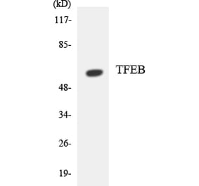 Western Blot - Anti-TFEB Antibody (R12-3617) - Antibodies.com