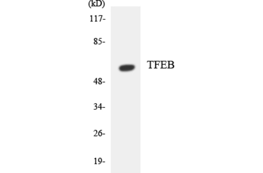 Western Blot - Anti-TFEB Antibody (R12-3617) - Antibodies.com