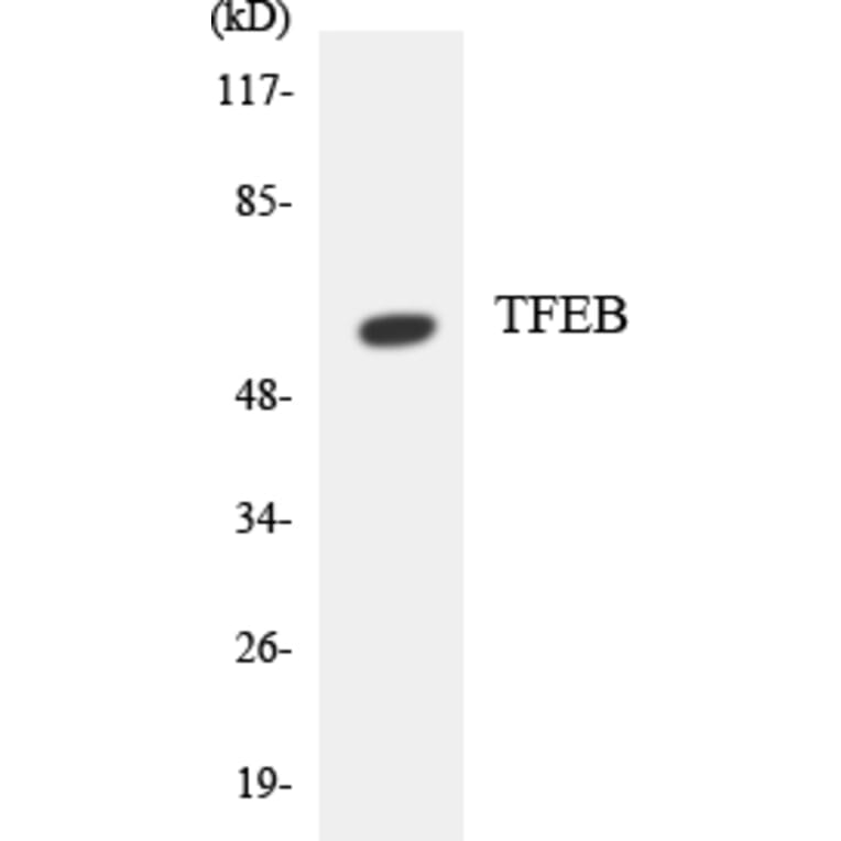 Western Blot - Anti-TFEB Antibody (R12-3617) - Antibodies.com